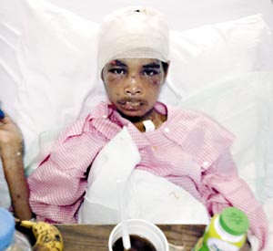 印尼女佣遭沙特雇主虐待 被剪掉嘴唇打断腿(图