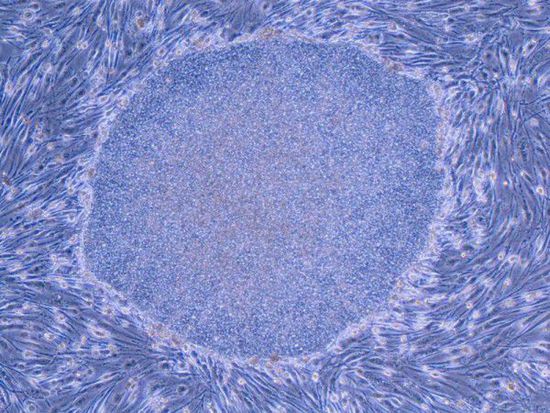 日本专家:新技术或让返老还童不再是梦