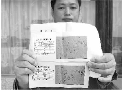 民工花1月工钱治前列腺炎 治愈前后化验单雷同