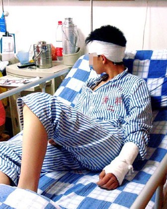 被打伤的阿强躺在医院病床上。记者 陈维摄 被打伤的阿强躺在医院病床上。记者 陈维摄