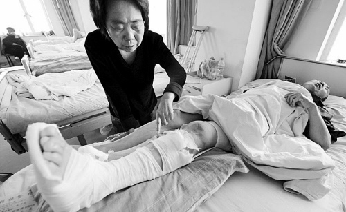 老李的左腿被撞成粉碎性骨折摄影王勇 老李的左腿被撞成粉碎性骨折摄影王勇