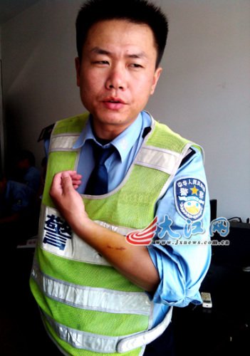 “倒霉”的张飞在4月份的一次执勤中被肇事车主用砍刀砍伤头部 “倒霉”的张飞在4月份的一次执勤中被肇事车主用砍刀砍伤头部