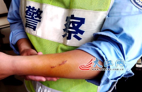 南昌市青云谱交警大队二中队民警张飞在查处一辆无牌摩托车时,被车主咬伤手臂。 南昌市青云谱交警大队二中队民警张飞在查处一辆无牌摩托车时,被车主咬伤手臂。