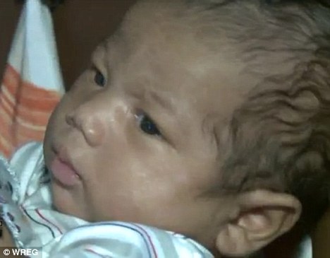 这名婴儿在两个月大才被发现长有12个脚趾。 这名婴儿在两个月大才被发现长有12个脚趾。