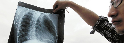 受伤民警的肋骨X光片。记者 林云龙 摄 受伤民警的肋骨X光片。记者 林云龙 摄