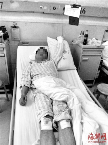 陈先生左手被砍,膝盖也在搏斗中擦伤了 陈先生左手被砍,膝盖也在搏斗中擦伤了