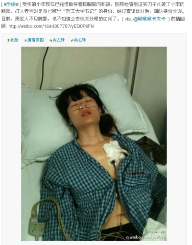 因排队起纠纷,女教师李亚娜被捅伤 因排队起纠纷,女教师李亚娜被捅伤