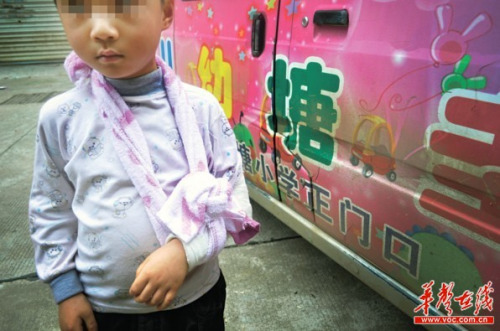 12月12日,浩博在长沙市圭塘小区幼儿园门口,他的左手被诊断为骨折。 实习生 李健 摄 12月12日,浩博在长沙市圭塘小区幼儿园门口,他的左手被诊断为骨折。 实习生 李健 摄