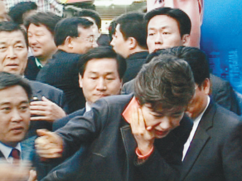 2006年5月20日,朴槿惠在街头遭到袭击,右脸被割伤。 2006年5月20日,朴槿惠在街头遭到袭击,右脸被割伤。