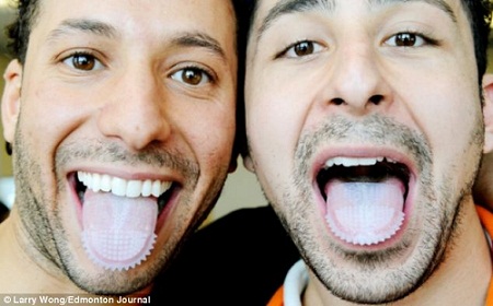 两名加拿大男子发明了一款套在舌头上使用的牙刷 两名加拿大男子发明了一款套在舌头上使用的牙刷