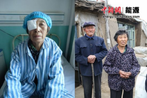 双眼重度白内障患者袁桂兰通过“中石化健康快车”的帮助现已重见光明。左图为袁桂兰刚做完手术(资料图)。右图为重见光明的袁桂兰和老伴在家门口合影。 双眼重度白内障患者袁桂兰通过“中石化健康快车”的帮助现已重见光明。左图为袁桂兰刚做完手术(资料图)。右图为重见光明的袁桂兰和老伴在家门口合影。