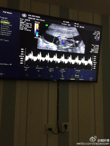 戴娇倩承认怀孕晒b超图新的身份新的生命