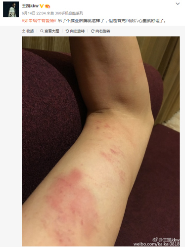 ����΢����ͼ��