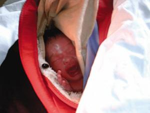 产妇丢下新生女婴提吊瓶逃出医院