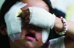 昨日,通州区台湖镇卫生院的病房内,5岁女童楠楠依偎在母亲怀中。7月13日,她被邻居家一只身长1米多的大狗咬伤脸部。看着女儿满脸厚厚的纱布(见图),楠楠父亲愁眉不展。