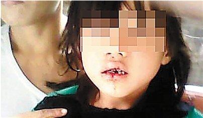 司机撞倒女孩谎称带其就医 塞几十元钱遗弃路边