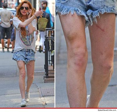 平日吸毒放荡的她尽管出乎意料的又挨过了一岁,但生日当天她腿上的一