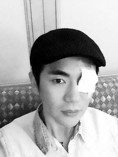 "温太医"张晓龙患眼疾 惨变"独眼龙"(图)