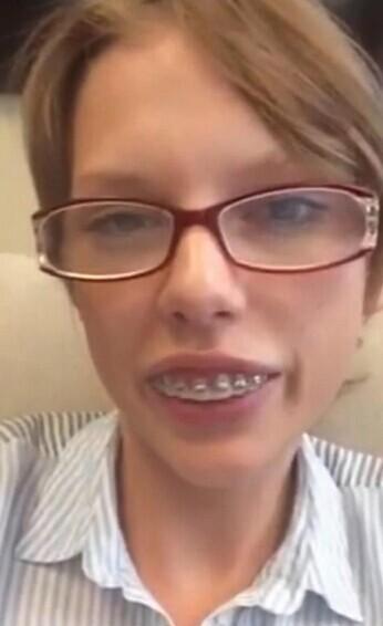 泰勒斯威夫特戴牙套自拍变身钢牙妹图