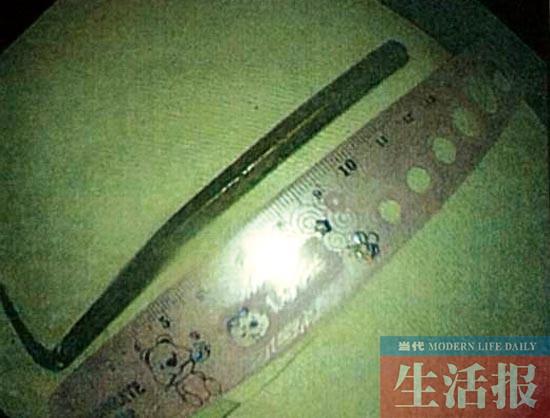 23��С�ｫ13���׳������¶� ����֮��ž�ҽ(ͼ)