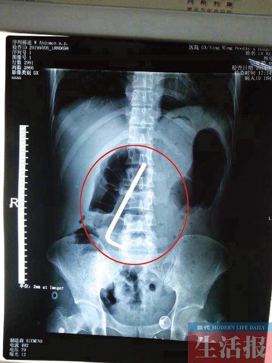 23��С�ｫ13���׳������¶� ����֮��ž�ҽ(ͼ)