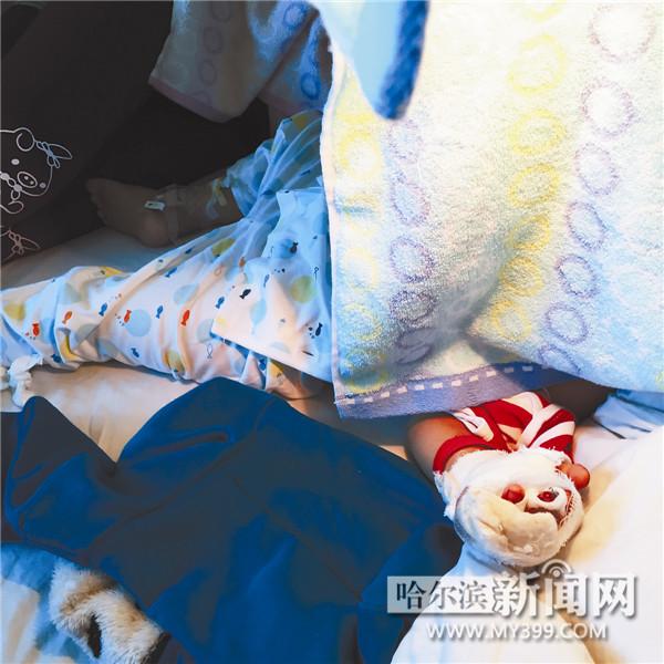 庆安县大罗镇的2岁男孩琦琦(化名)趁家人不注意,将左手插入玉米粉碎机