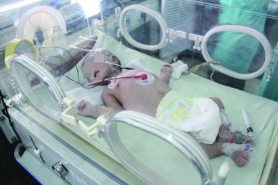 海南一先天生殖器畸形婴儿被遗弃警方介入图