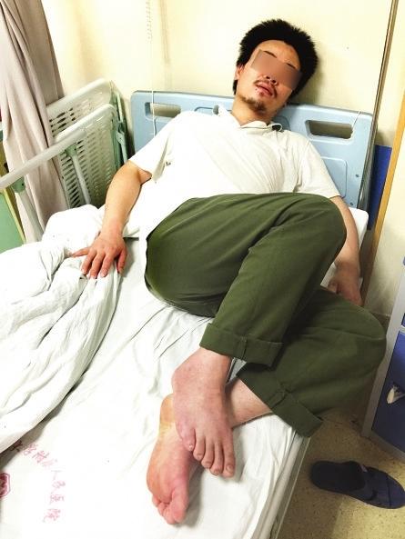 长乐男子被马蜂蜇毒蛇咬 靠吃草药喝溪水爬回家