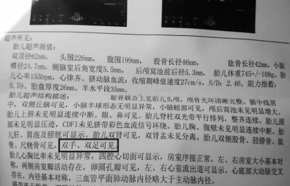 不止要看b超报告单！上海集爱试管全部检查项目汇总