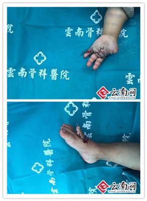 С����������ָ�����ϣ�ʳָ��ʱ�ڽ��ϼ���