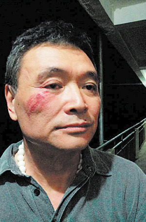 马原未发现严重内伤发微博后县委书记县长看望(2)