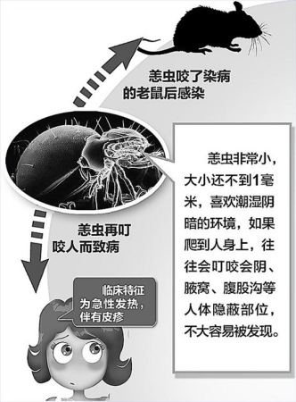 专家称恙虫病可防可治:雨后勿坐草坪远离鼠类