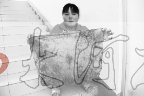 ҽ��ΪŮ�ӽ�����������һ�鲼�����ⳤһ��ͼ��