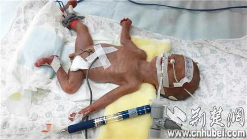 ��������������ɻ����ʱ����Բ��ʴ�С��ͼ��