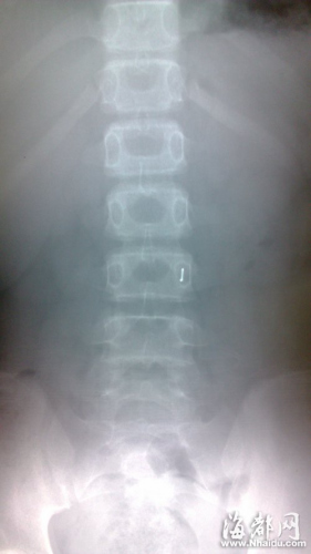 ����������Ů�������̡���߽��ҡ��ָ�ʹ����