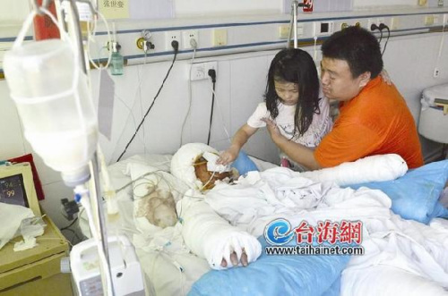 煤气泄漏闪燃女子全身着火治疗十几天仍未脱险(图)