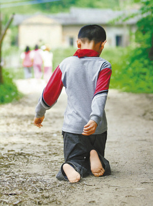 坚强少年天生残疾以膝代步4年来坚持跪行上学