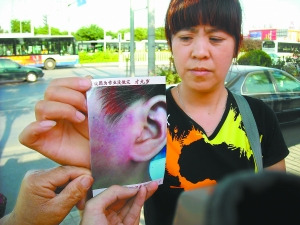 少年未完成作业遭老师扇耳光致伤打人者被拘留