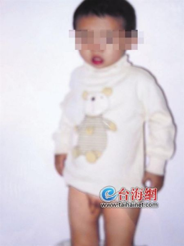 幼儿园2岁男童因尿床被园长拽伤生殖器(图)