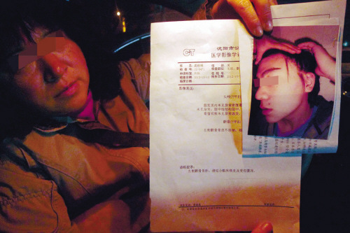 学生上课玩手机被老师打伤学校:打人者是临时工