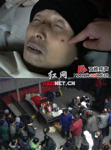 ���ػ�����Ȱ��Ů�Ӷ������������ٷ���ϵ���