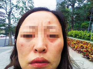 女子称丈夫与侄女发生婚外情并施家暴(图)
