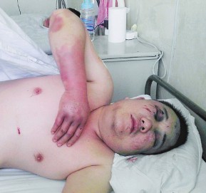 十余人除夕夜因琐事起冲突持枪斗殴致4人受伤