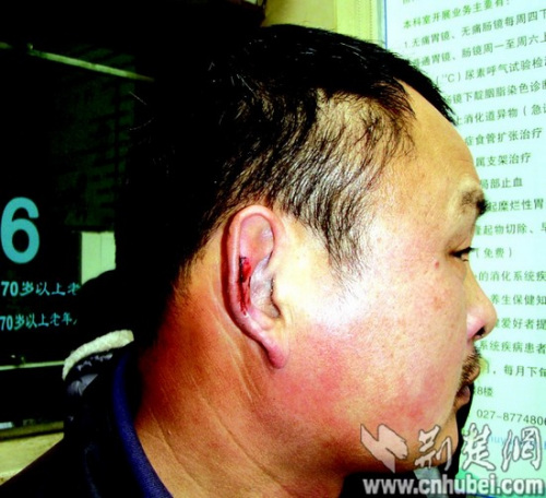 环卫工弄脏挡道轿车遭暴打致头部严重外伤(图)