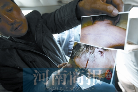 男子酒驾被交警带走询问后死亡眉脸有血迹(图)