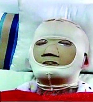 少女拒绝求爱遭毁容续:家人否认索赔千万元(图)