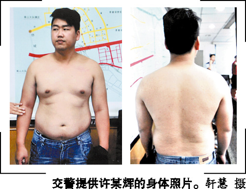 深圳飙车案车主照片公布额头下巴胸部无伤痕(图)
