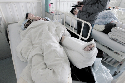 女子遭车祸腿被轧变形肇事车主称其为“碰瓷”