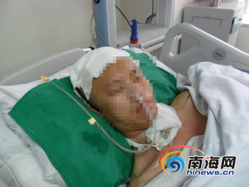 海南男子闹事被带进派出所颅骨断裂或成植物人