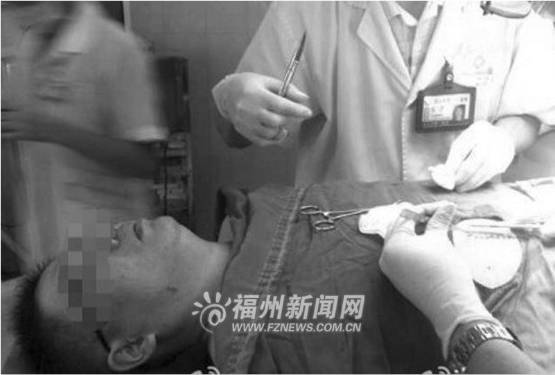 癌症未治愈福建长乐一病人持刀砍伤医生(图)